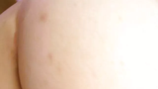 enxocada estudiante medicina videos ponos en castellano